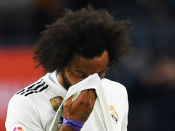 Real Madrid confirm Marcelo hamstring injury