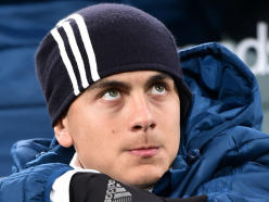 Benched Dybala needed rest, Allegri claims